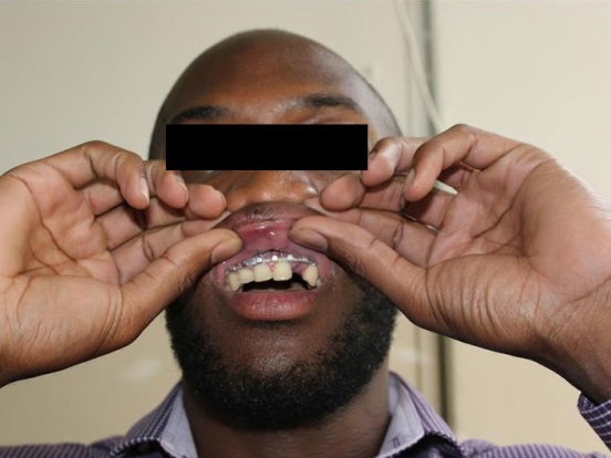 IRS Investigates Alleged Racial Attack on Inter-Racial Couple